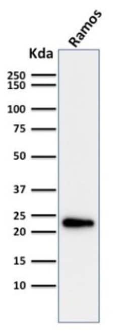 LMO2 Antibody (LMO2/1971) - Azide and BSA Free, Novus Biologicals 100 &mu;g | Buy Online | Novus Biologicals | Fisher Scientific